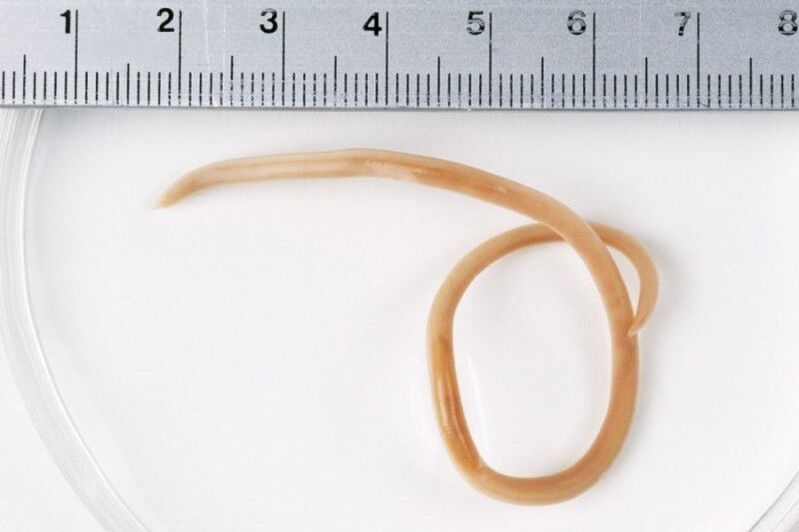 the size of the worms in the body