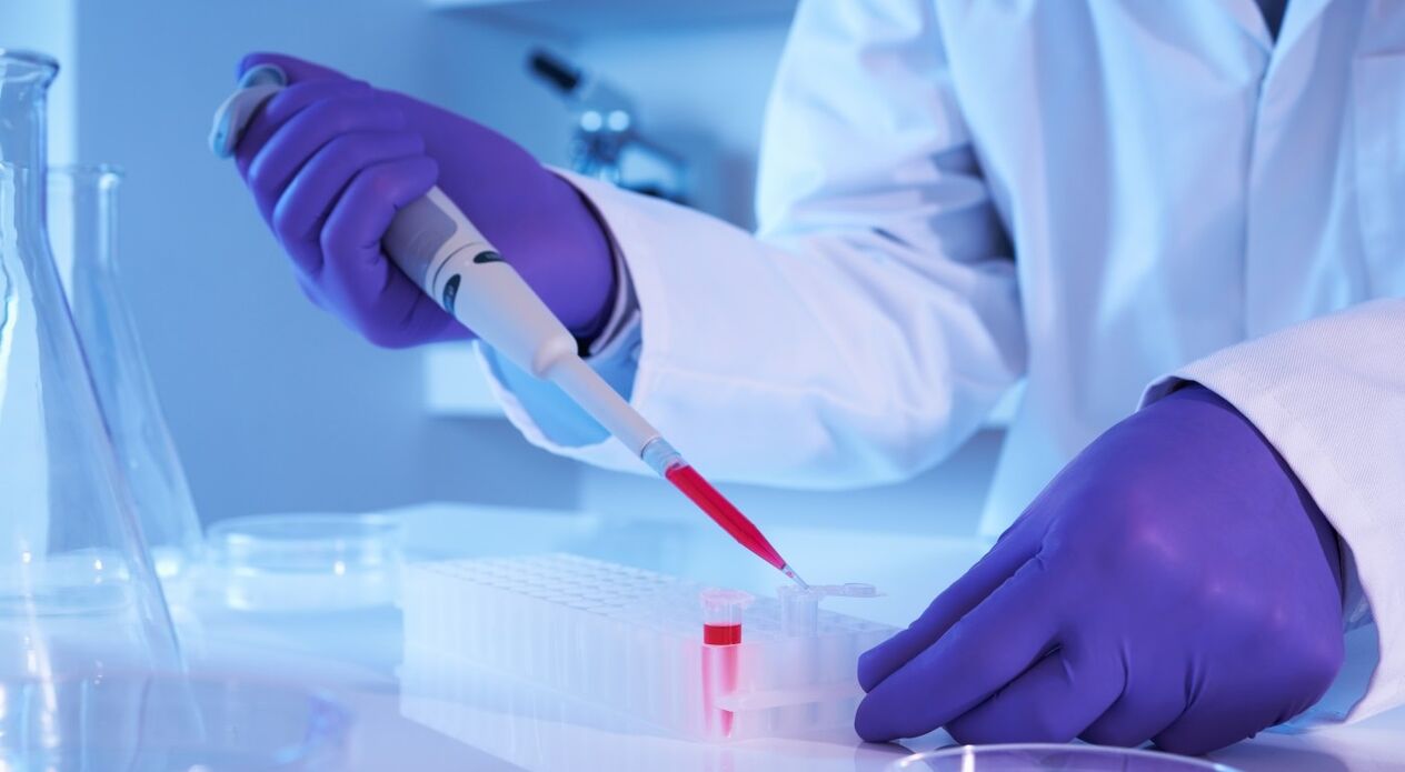 How to take the parasite analysis