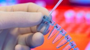 How to test for parasites
