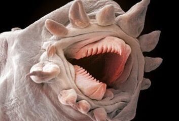 What worms can live in the human body