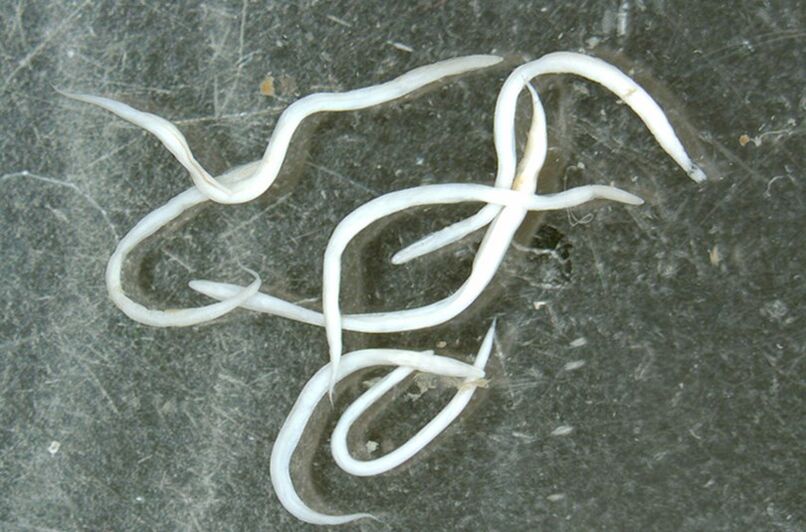 worm parasite from the human body