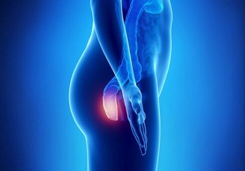 Itching in the rectum as an indicator for checking for parasites