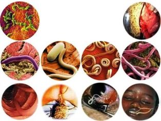 How to get rid of parasites from the body with folk remedies